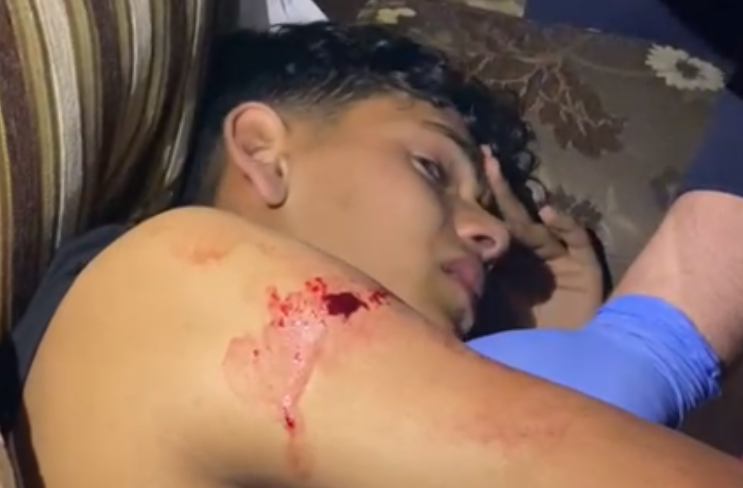 Adolescente gerosolimitano ferito da un colono