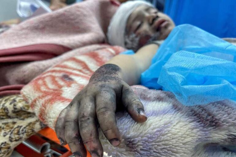 Genocidio a Gaza: la soluzione finale israeliana contro bambini e famiglie? Foto e video